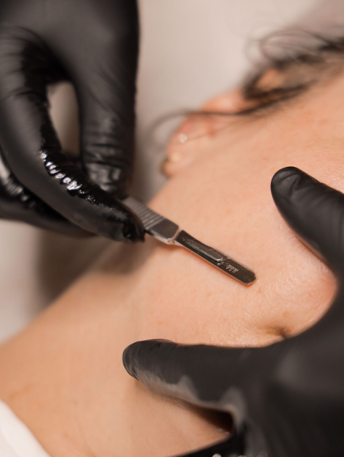 Dermaplane
